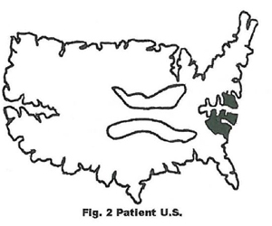 这是一张美国地图的照片，它被做成了大脑的样子。