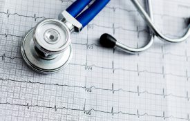 心电图打印输出上的听诊器特写。