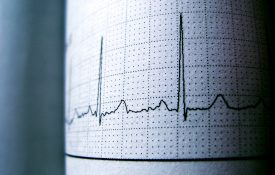 窦性心律与心电图